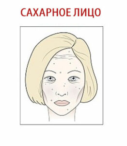 сахарное лицо