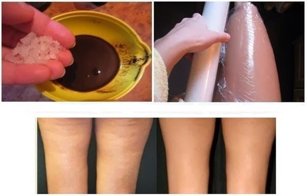Курс из 5 обертываний убирает несколько сантиметров с талии и бедер!