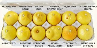 Это фото поможет вам определить рак груди