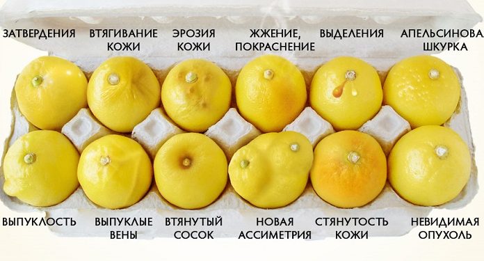 Это фото поможет вам определить рак груди