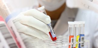 Как предупредить болезни? 10 анализов, которые нужно сдать каждому