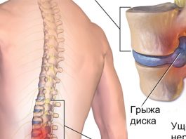 Хирург отговорил меня от операции и посоветовал делать эту зарядку Хирург отговорил меня от операции