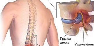 Хирург отговорил меня от операции и посоветовал делать эту зарядку Хирург отговорил меня от операции