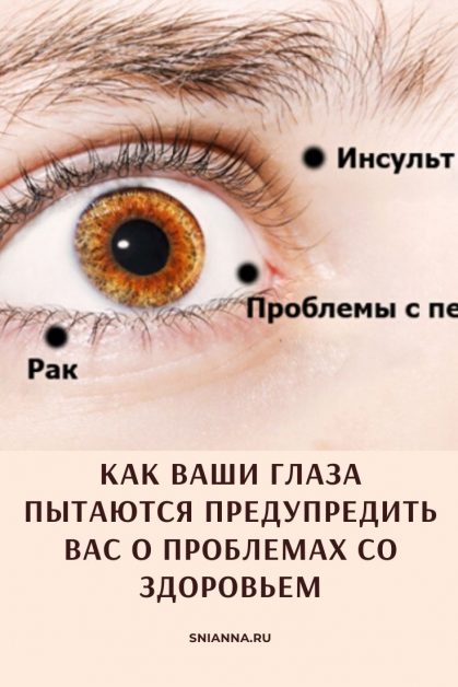 Диагностика по глазам