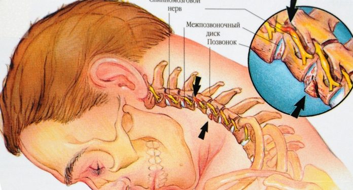 Свободная шея: 9 лучших упражнений для шейного отдела позвоночника
