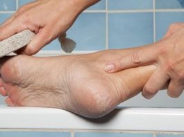 Волшебное средство для ваших пяточек. Моментальный эффект