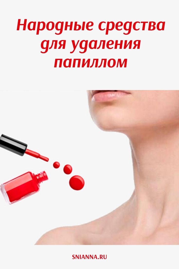 Народные средства для удаления папиллом