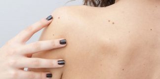 Как по родинкам определить предрасположенность к богатству и успеху
