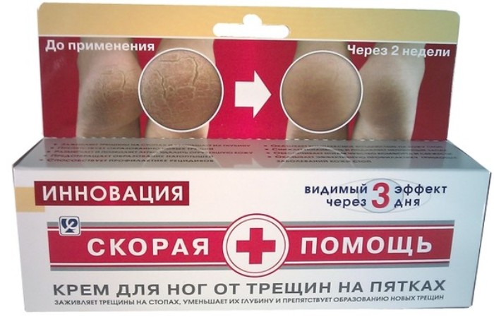 Как избавиться от трещин на пятках