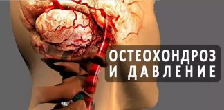 Шейный остеохондроз и высокое давление как неразлучная парочка