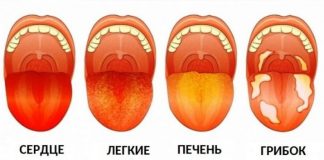 3 вещи, которые ваш язык пытается рассказать о вашем здоровье