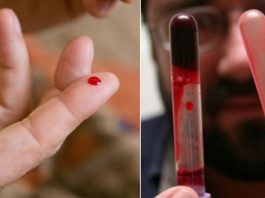 Кардиолог: «Эти 7 продуктов разжижают густую кровь, обязательно включите их в рацион!»