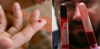 Кардиолог: «Эти 7 продуктов разжижают густую кровь, обязательно включите их в рацион!»