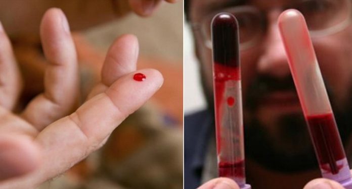 Кардиолог: «Эти 7 продуктов разжижают густую кровь, обязательно включите их в рацион!»