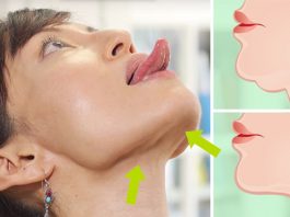 10 способов устранения двойного подбородка