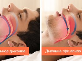 5 признаков того, что вы страдаете от апноэ сна, не понимая этого