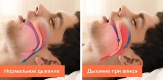 5 признаков того, что вы страдаете от апноэ сна, не понимая этого