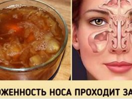 Замечательное средство от заложенного носа. Будете свободно дышать уже на утро!