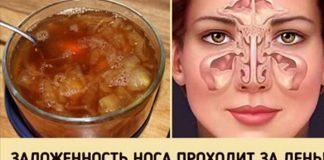 Замечательное средство от заложенного носа. Будете свободно дышать уже на утро!