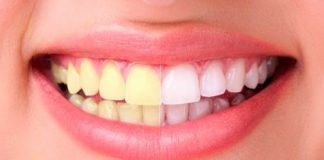Белые и здоровые зубы: 8 хитростей дают 100% результат!