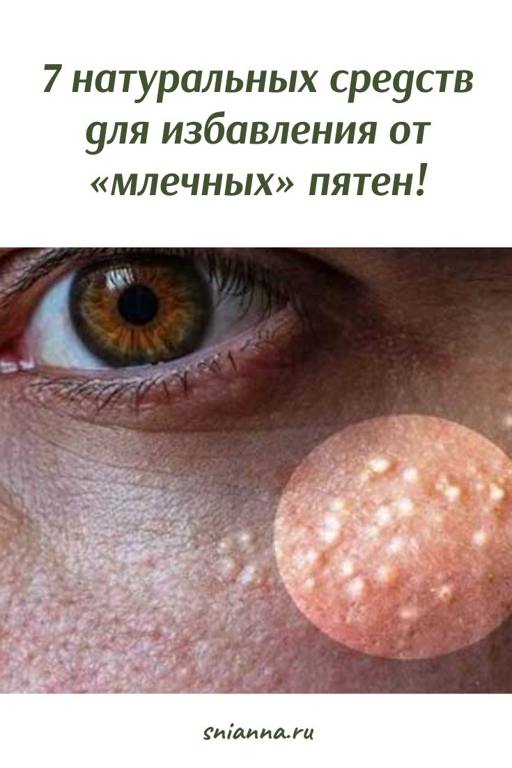 средства для избавления от «млечных» пятен