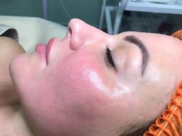 Умывайтесь с яблочным уксусом каждый день, и вот что произойдет через 5 дней