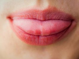7 признаков, что у вас недостаток витамина B12 недостаток витамина B12