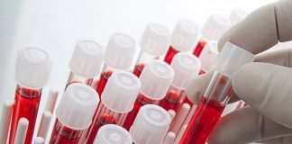 10 анализов, которые стоит сдать, если не можете похудеть