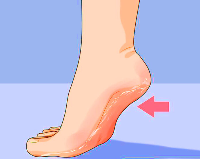 content_How-to-remove-cracked-heels